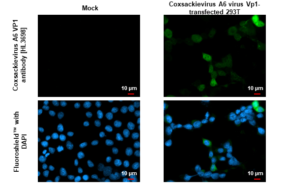 邦楽 Jenovavirus Demo #1 Anti-Coxsackievirus A6 VP1 antibody [HL3698] (GTX641870) | GeneTex